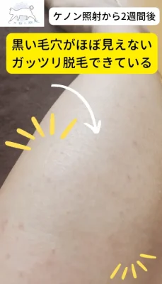 ケノン使用画像2