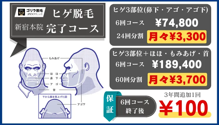 ゴリラクリニック新宿ヒゲ脱毛完了コース