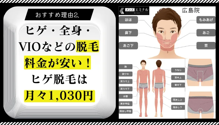 メンズエミナル広島おすすめ理由2