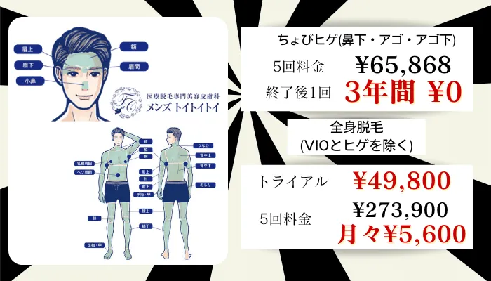 メンズトイトイトイ比較料金