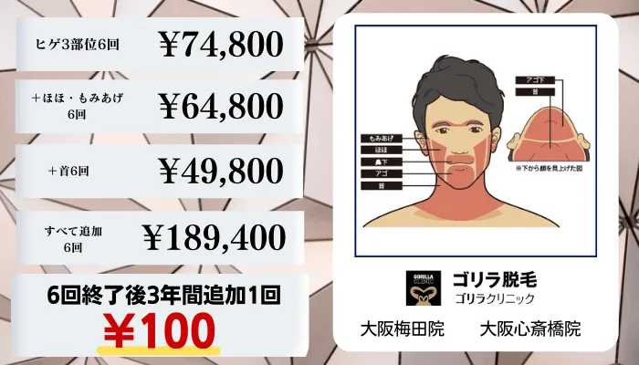 ゴリラクリニック大阪比較料金ヒゲ