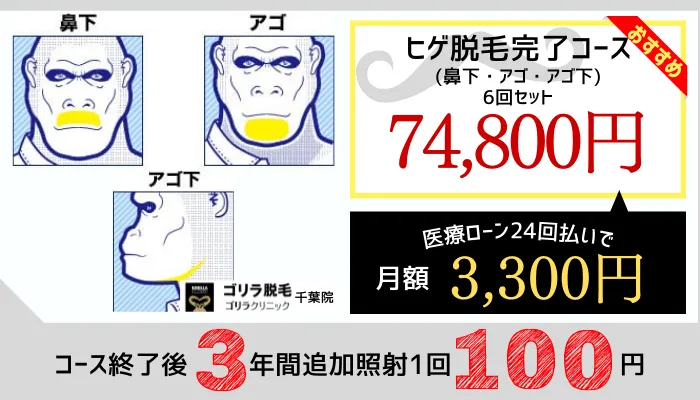 ゴリラ千葉ヒゲ脱毛料金