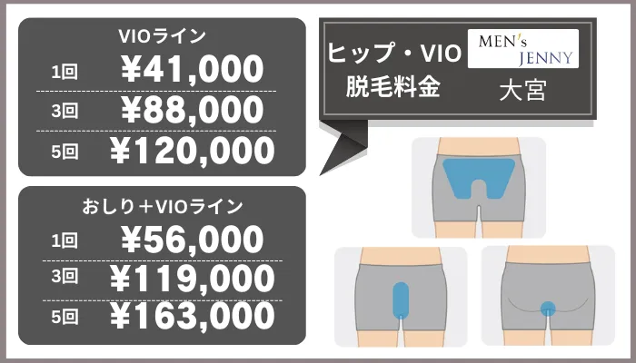 メンズジェニー大宮ヒップ・VIO脱毛料金