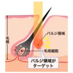 蓄熱式