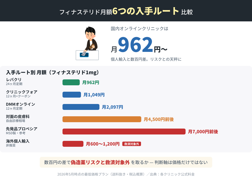 フィナステリド月額 6つの入手ルート比較
